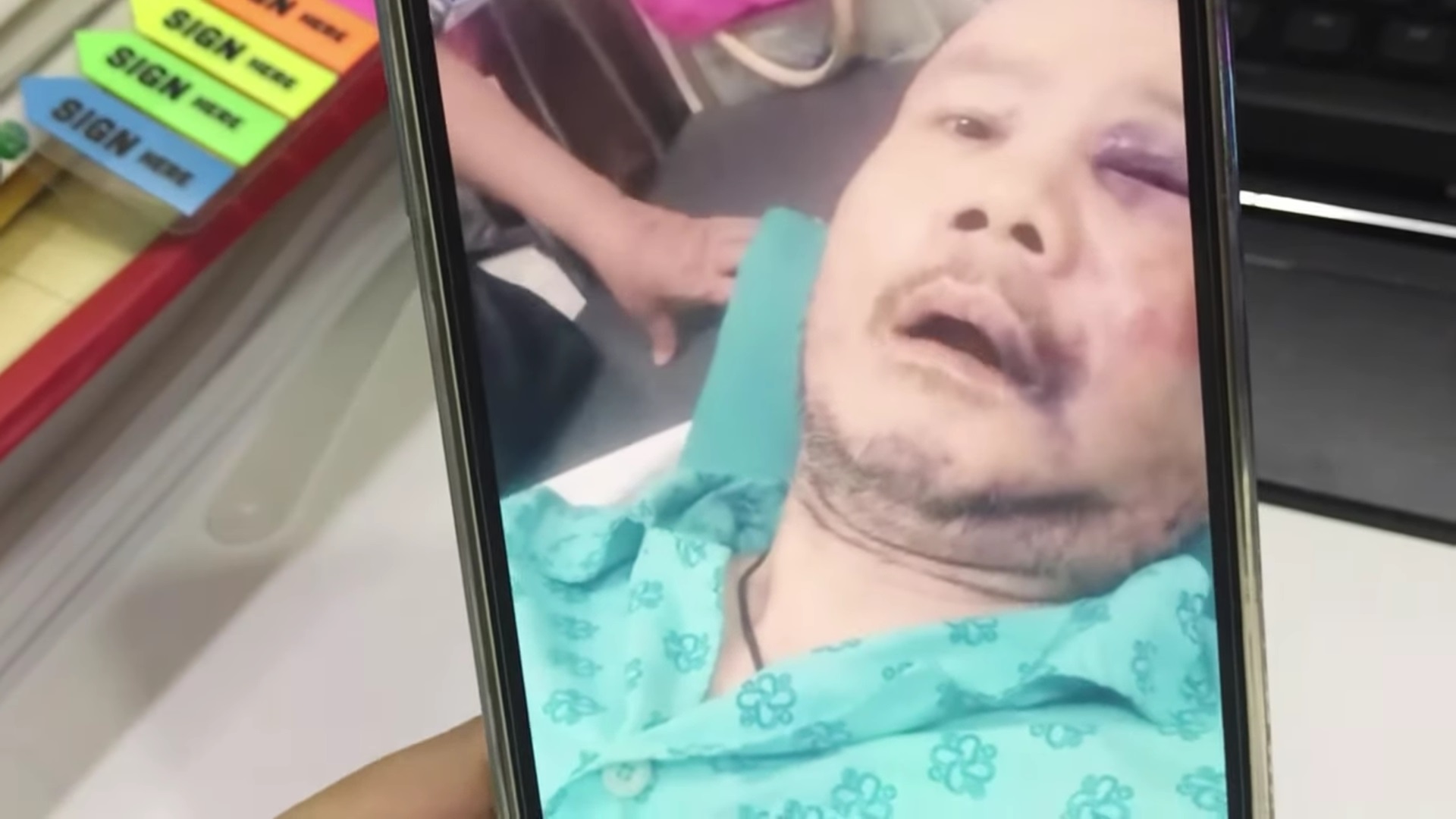 Ca sĩ Tô Thanh Phương nằm viện, tiết lộ lý do nhảy lầu: 'Tôi bị sốc, sợ bị mù' - 1