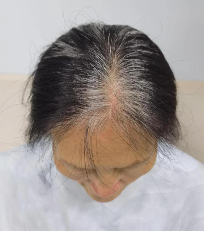 8 đồ dùng là 'kẻ thù' của sức khỏe, chúng ẩn nấp trong 90% gia đình Việt - 10