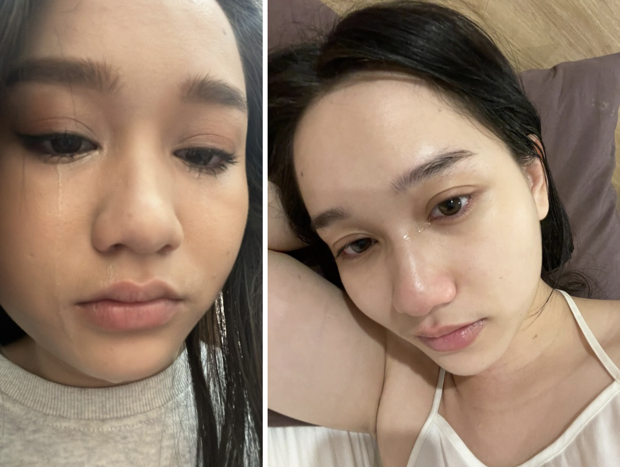 Trúc Anh (Mắt Biếc) công khai hình ảnh lạ lúc tăng cân: Không thể đi nhanh, khóc vì thay đổi gây sốc của cơ thể - 5 Trúc Anh (Mắt Biếc) công khai hình ảnh lạ lúc tăng cân: Không thể đi nhanh, khóc vì thay đổi gây sốc của cơ thể - 5